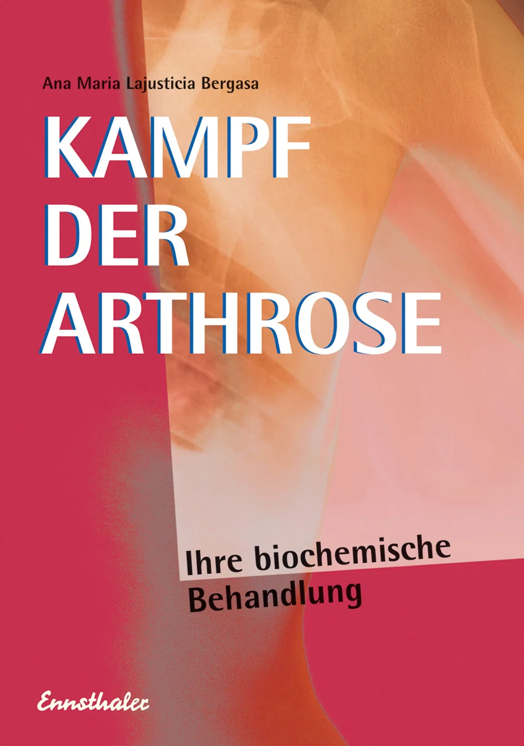 Kampf der Arthrose - Ana Maria Lajusticia Bergasa – Bild 1